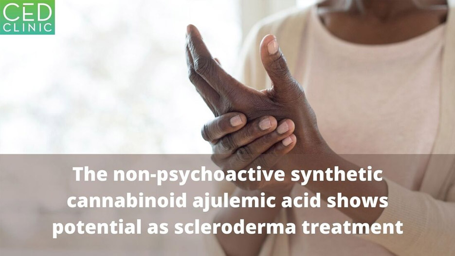 Synthetic cannabinoid Ajulemic acid exerts potent antifibrotic effects in experimental models of systemic sclerosis