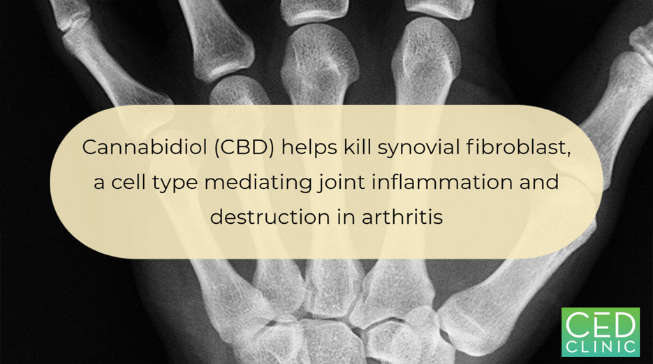 Cannabidiol (CBD): a killer for inflammatory rheumatoid arthritis synovial fibroblasts